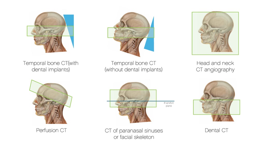 CT Head positioning overview